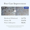 Medicube Zero Pore Blackhead Mud Mask (100g)